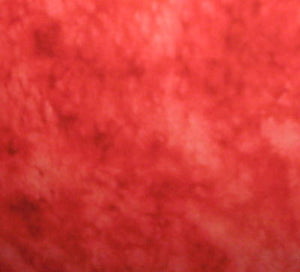 Splash 3504.POPPY